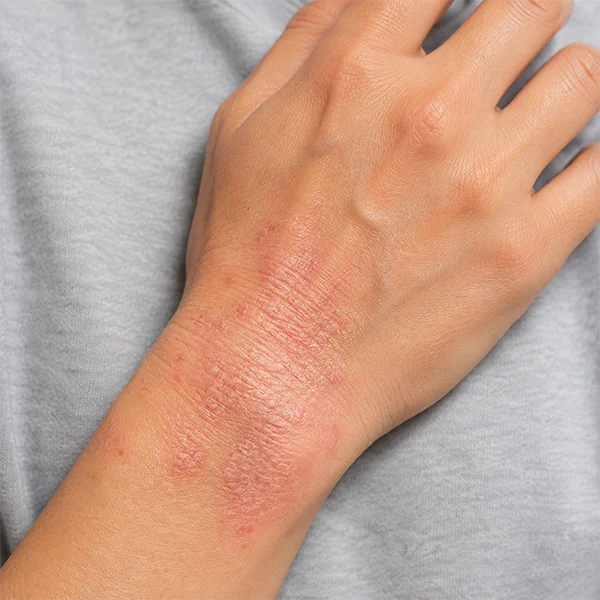 Trigger Point Therapy